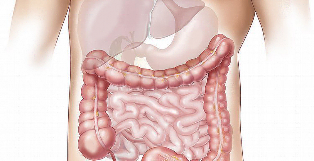 Přednáška o prevenci rakoviny tlustého střeva